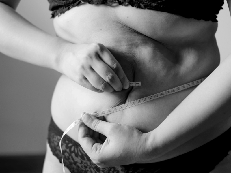 Person standing on a scale looking frustrated, symbolizing struggles with weight loss